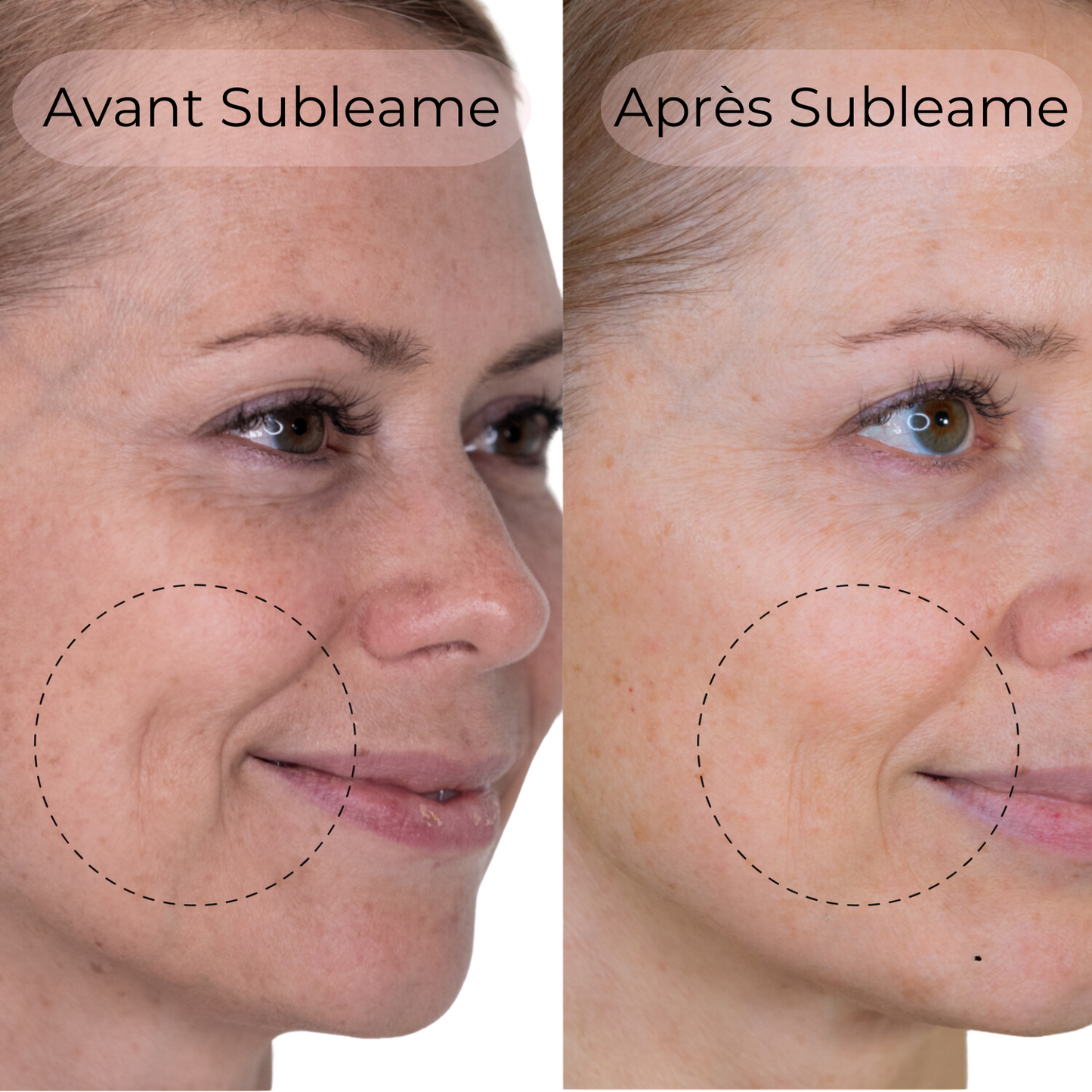 Masque au Collagène BioActive®