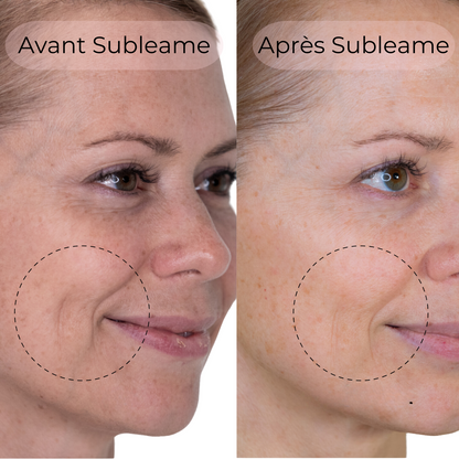 Masque au Collagène BioActive®