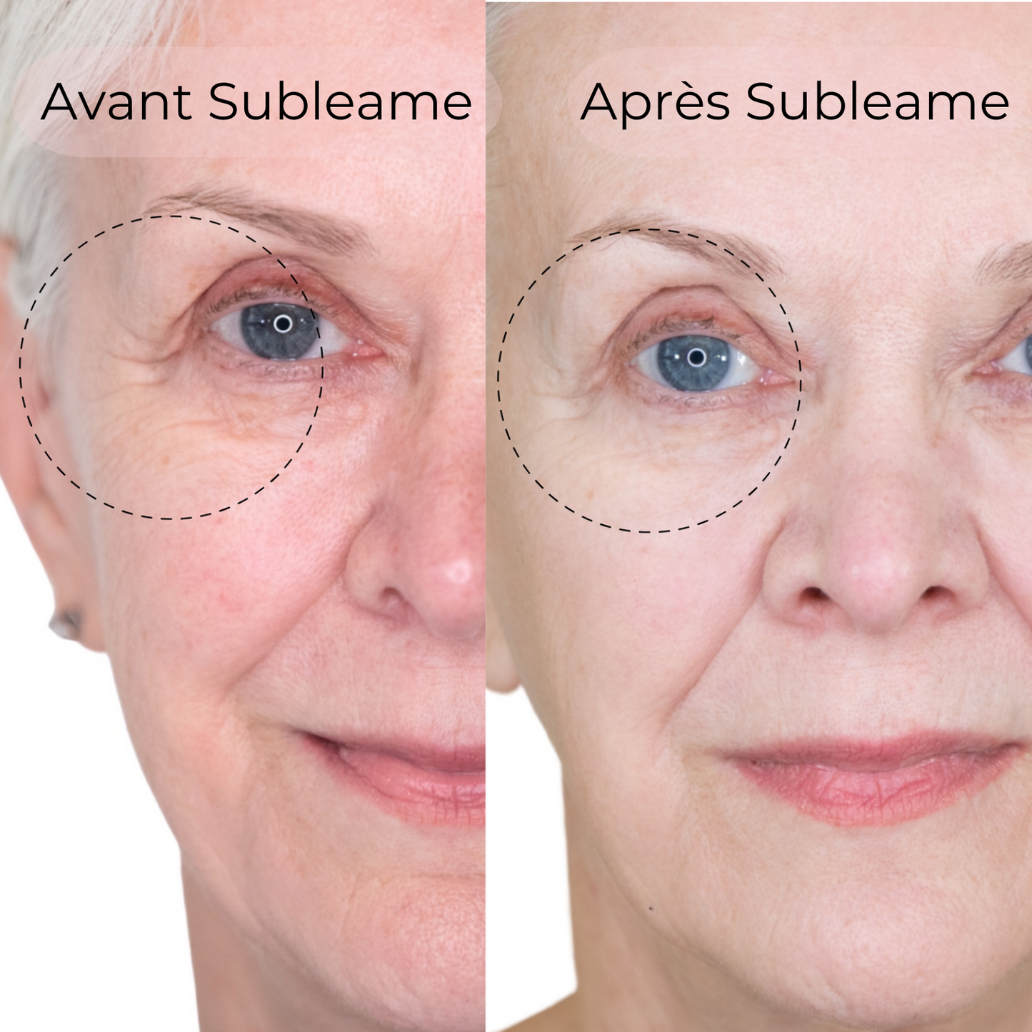 Masque au Collagène BioActive®