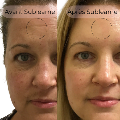 Masque au Collagène BioActive®