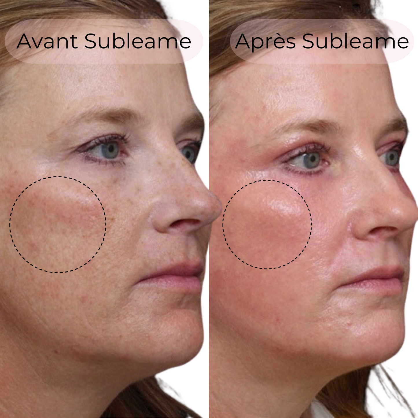 Masque au Collagène BioActive®